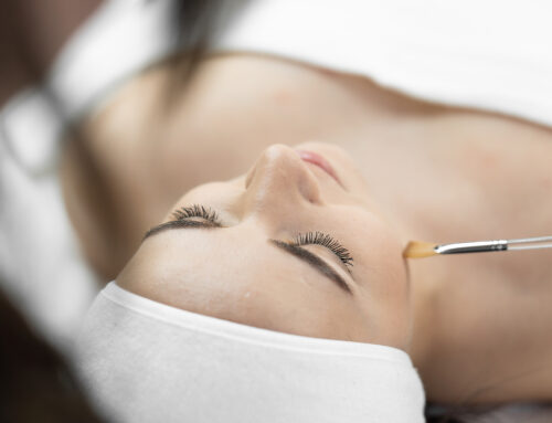 How Can Chemical Skin Peels Make You Look Years Younger?